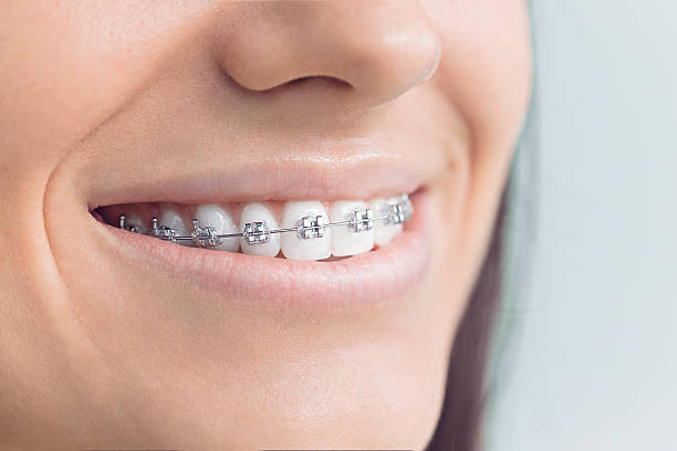 Best Traditional Braces  in , AK